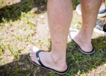 Santa Catarina ultrapassa os cem casos de febre do maruim