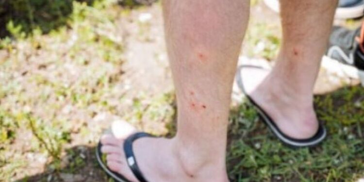 Santa Catarina ultrapassa os cem casos de febre do maruim