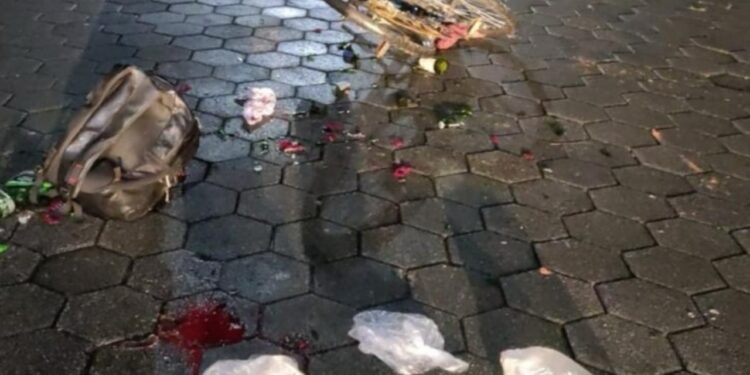 Ladrão furta cervejas e salgados, cai de bicicleta e é preso no hospital em Massaranduba